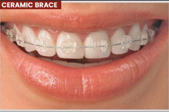 Ceramic-bace